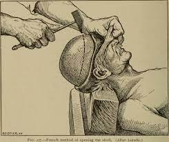 Sunday Morning Post Mortem Links