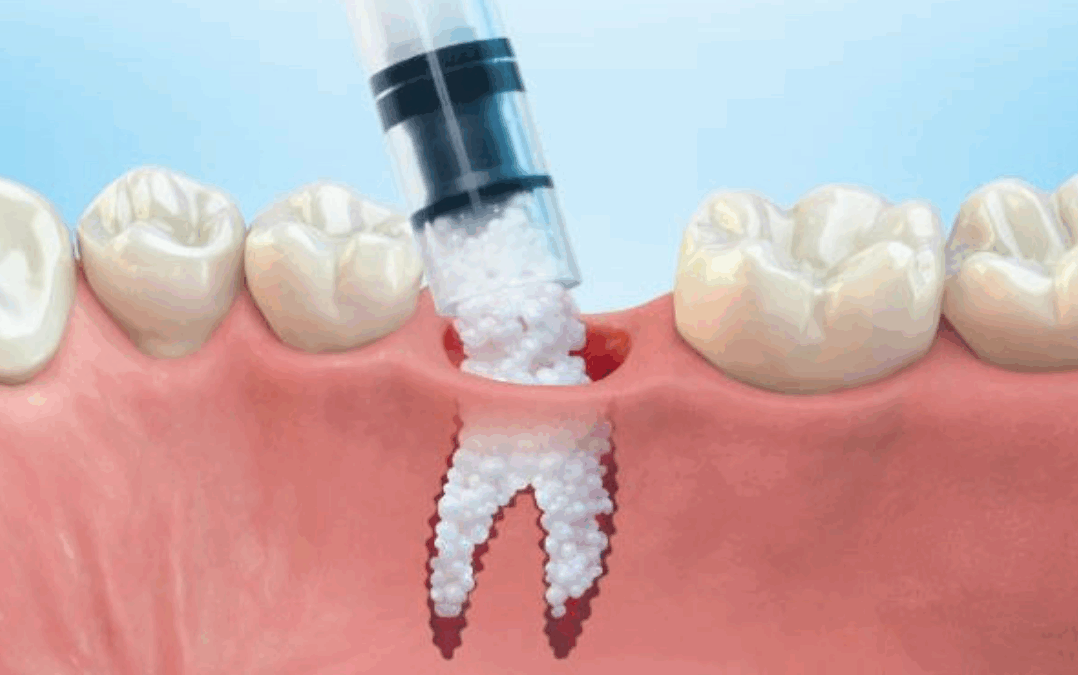 IFLA:  The “Hole in my Head” Edition of the Horoscope for the Week of May 4